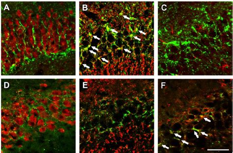 GABA Transporter Subtypes Double Labeled With Neuronal And Glial