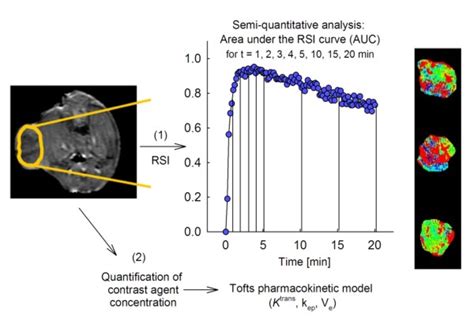 Dynamic Contrast Enhanced Mri Of Experimental Prostate Cancer