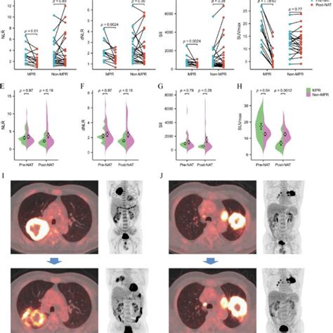 Distribution Of 18 F FDG PET CT Metabolic Parameters And Inflammatory