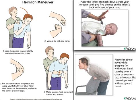 Heimlich Maneuver Instructions