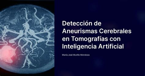 Detecci N De Aneurismas Cerebrales En Tomograf As Con Inteligencia