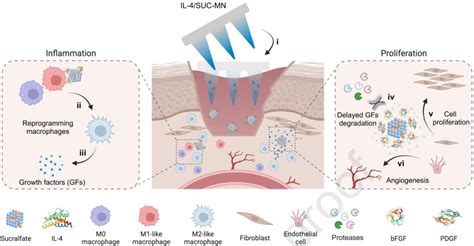 纳米人 Biomaterials：生物活性硫糖铝基微针可通过重编程巨噬细胞和保护内源性生长因子促进伤口愈合