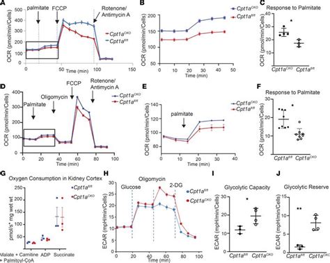 Jci Insight Tubular Cpt A Deletion Minimally Affects Aging And