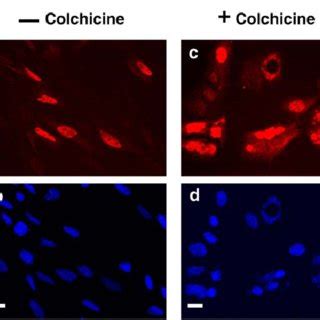 Disruption Of The Microtubule Network Does Not Affect The Nuclear