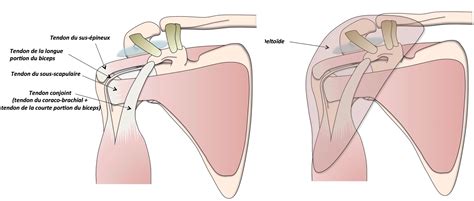 Anatomie De L Paule Clinique Ost O Articulaire Des C Dres Grenoble