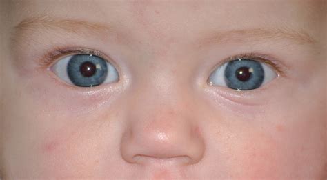 Baby Face With Blue Eyes Free Image Download