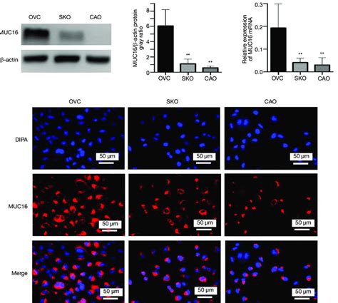 The Expression Of Muc Protein And Mrna In Human Ovarian Cancer Cell