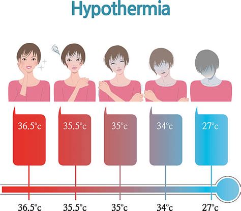 700개 이상의 체온 저하 스톡 일러스트 Royalty Free 벡터 그래픽 및 클립 아트 Istock