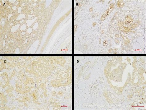 Photomicrographs Of The Immunohistochemical Staining Of NP 1 Stained