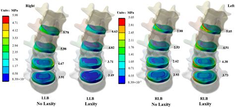 Bioengineering Free Full Text The Effect Of Concave Side