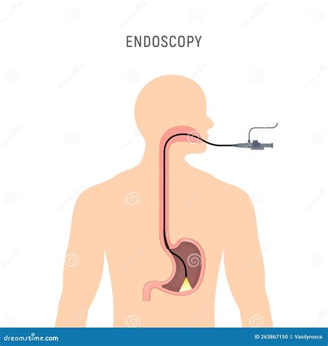 Endoscopy Stomach Anatomy Equipment Vector Illustration Esophagus