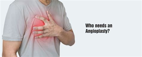 Risks And Complications Of Angioplasty What You Need To Know Risks And