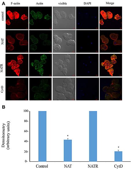 Frontiers Identification Of S Nitrosylated Sno Proteins In