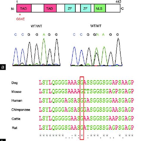 A Missense Mutation Of The Gata Gene Identified In Patients With Noa