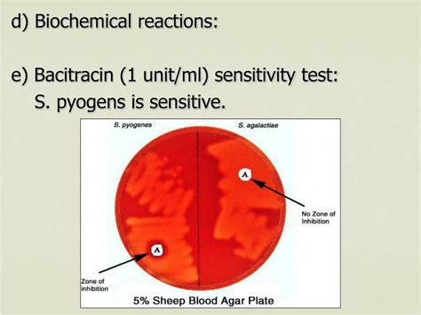 Ppt Streptococcus Powerpoint Presentation Free Download Id5596913