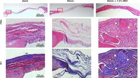 Histological Analysis Of Bone Regeneration In Calvarial Defects 6