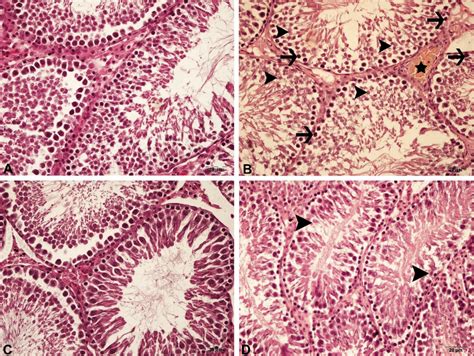 Testicular Tissues Control And Pge Group Normal Histological