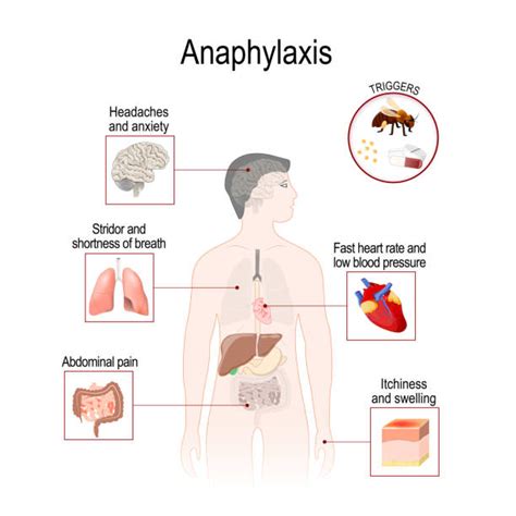 Nkda Allergy How To Discuss