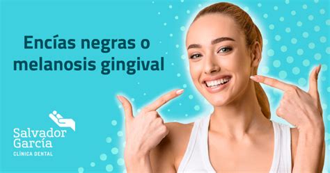 Encías negras o melanosis gingival Salvador García