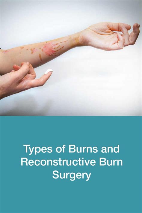 Burns Types And Reconstructive Burn Surgery In 2020 Types Of Burns Burns Cosmetic Surgery