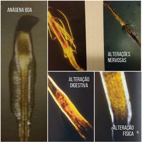 Microscopia Tricol Gica Em Luz Polarizada Uma An Lise Detalhada Da