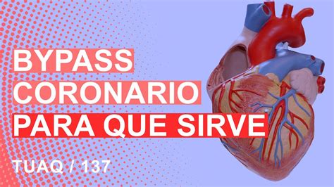 Para qué sirve un bypass Qué es un baypass en el corazón YouTube