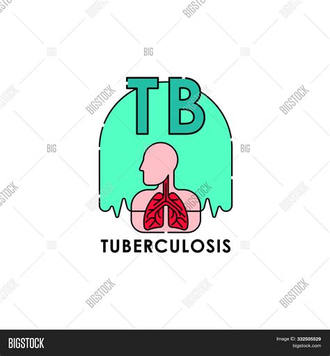 Tuberculosis Vector And Photo Free Trial Bigstock