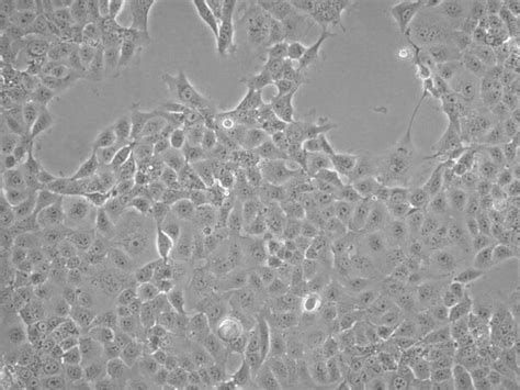 Hcc827 Gr6 Human Lung Adenocarcinoma Cell Line Scc426