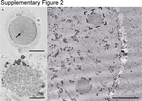 The Ultrastructural Nature Of Human Oocytes Cytoplasmic Abnormalities And The Role Of