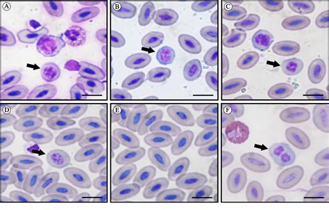 Figure 1 From Hematological Morphological And Morphometric