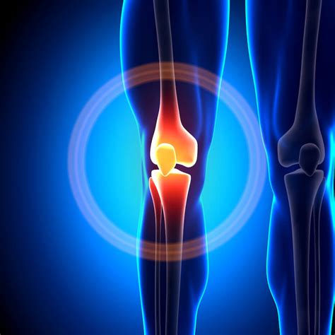 Knee | Condition Groups | Direct Orthopedic Care