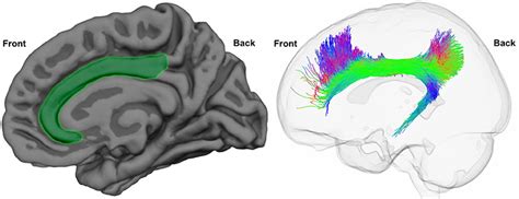 Learning From Mistakes How Does The Brain Handle Errors Frontiers