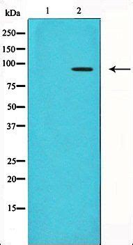 TLR4 Antibody Biorbyt