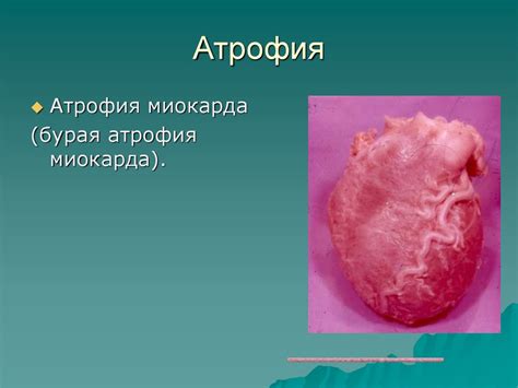 Процессы адаптации, гиперплазия, гипертрофия, атрофия, метаплазия ...