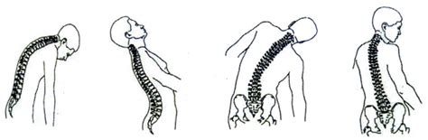 Funktionelle Anatomie Wirbelsäule Rumpf Diagram Quizlet