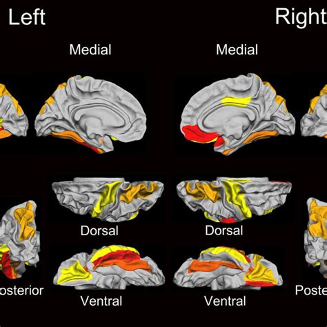 Cortical Regions Showing Significant Mediator Effect Of Cortical Area