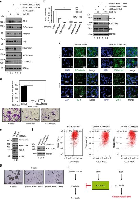 Kiaa Promotes Egf Dependent Emt In Cervical Cancer Cells A