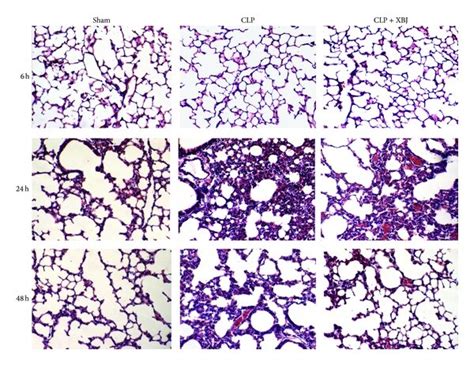 Xuebijing XBJ Inhibits Inflammation In The Injured Lung A