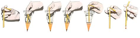 Metodo De Hoffman - Esquema do procedimento de transferência de volume com canudo para ...