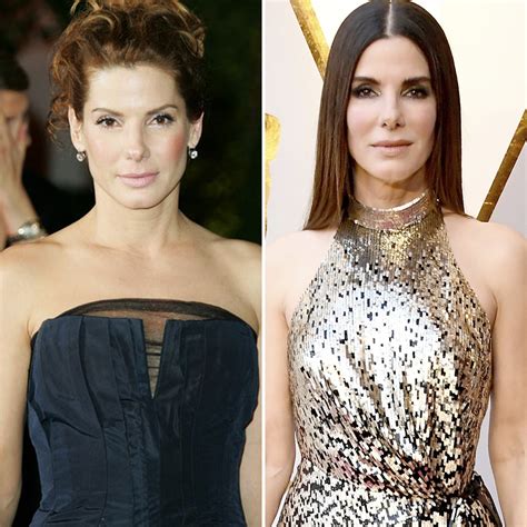 Sandra Bullock Chirurgie Plastique Les Experts Pèsent Sur Son Botox