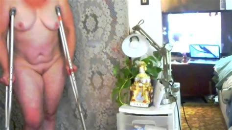 Curvy Dawnskye Hopping Around On Crutches In The Nude Allows Viewer To Imagine Rescuing Me I