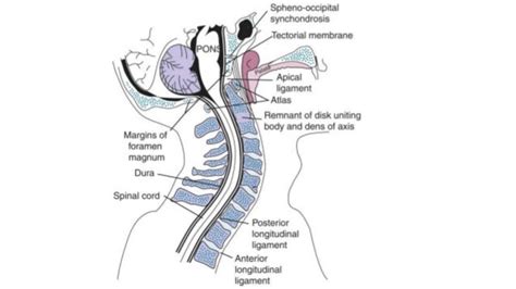 Craniovertebral Junction Anomalies