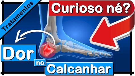 Incr Veis Rem Dios Caseiros Para Dor No P E Calcanhar Youtube