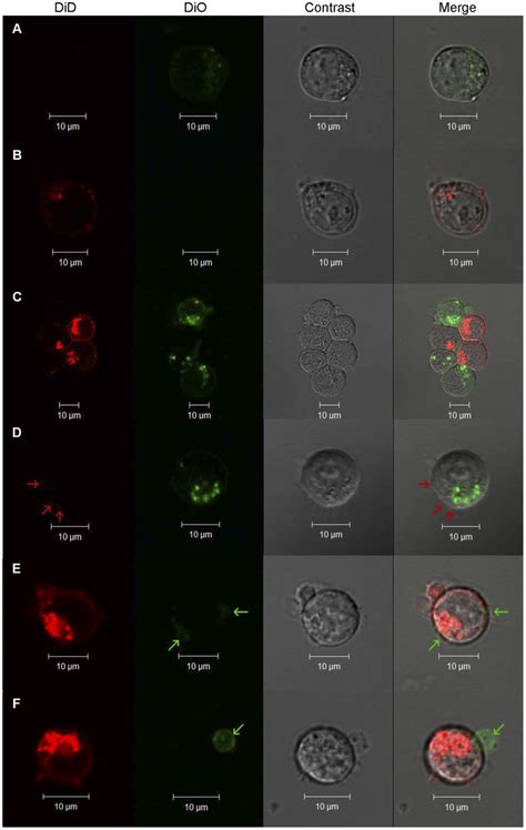 Confocal Microscopy Of Stained Jurkat Cells Representative Confocal