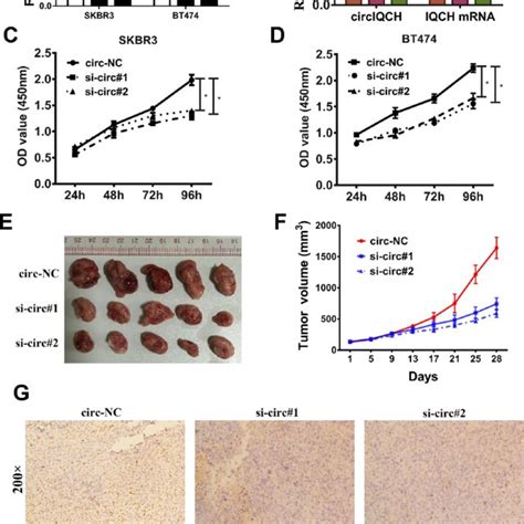 Downregulation Of Circiqch Suppresses The Proliferation Of Breast