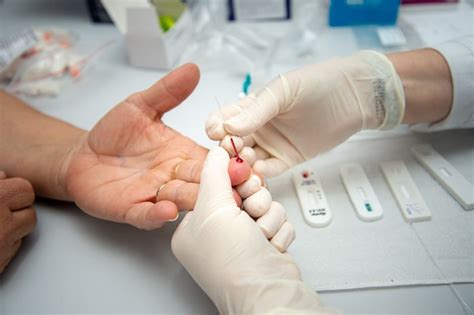 Sa De Oferece Atendimento E Tratamento De Apoio A Pacientes Hiv Em