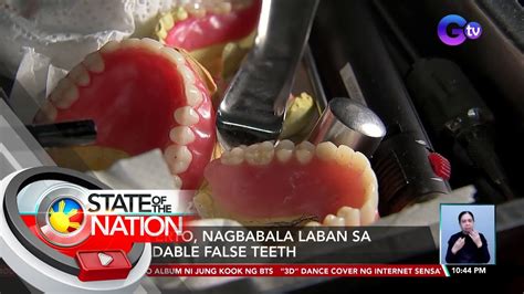 Eksperto Nagbabala Laban Sa Moldable False Teeth SONA YouTube