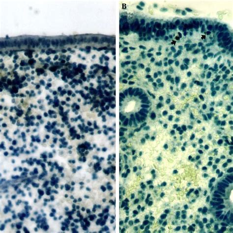 Apoptotic Cells In The Infertile A And Fertile B Endometrial Download Scientific Diagram