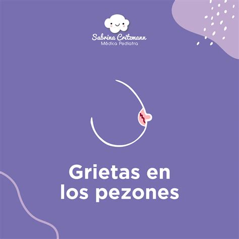 Grietas En Los Pezones Sabrina Critzmann Pediatra