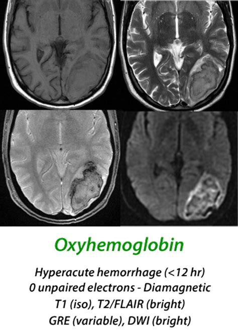 Hematoma overview MRI - Questions and Answers in MRI